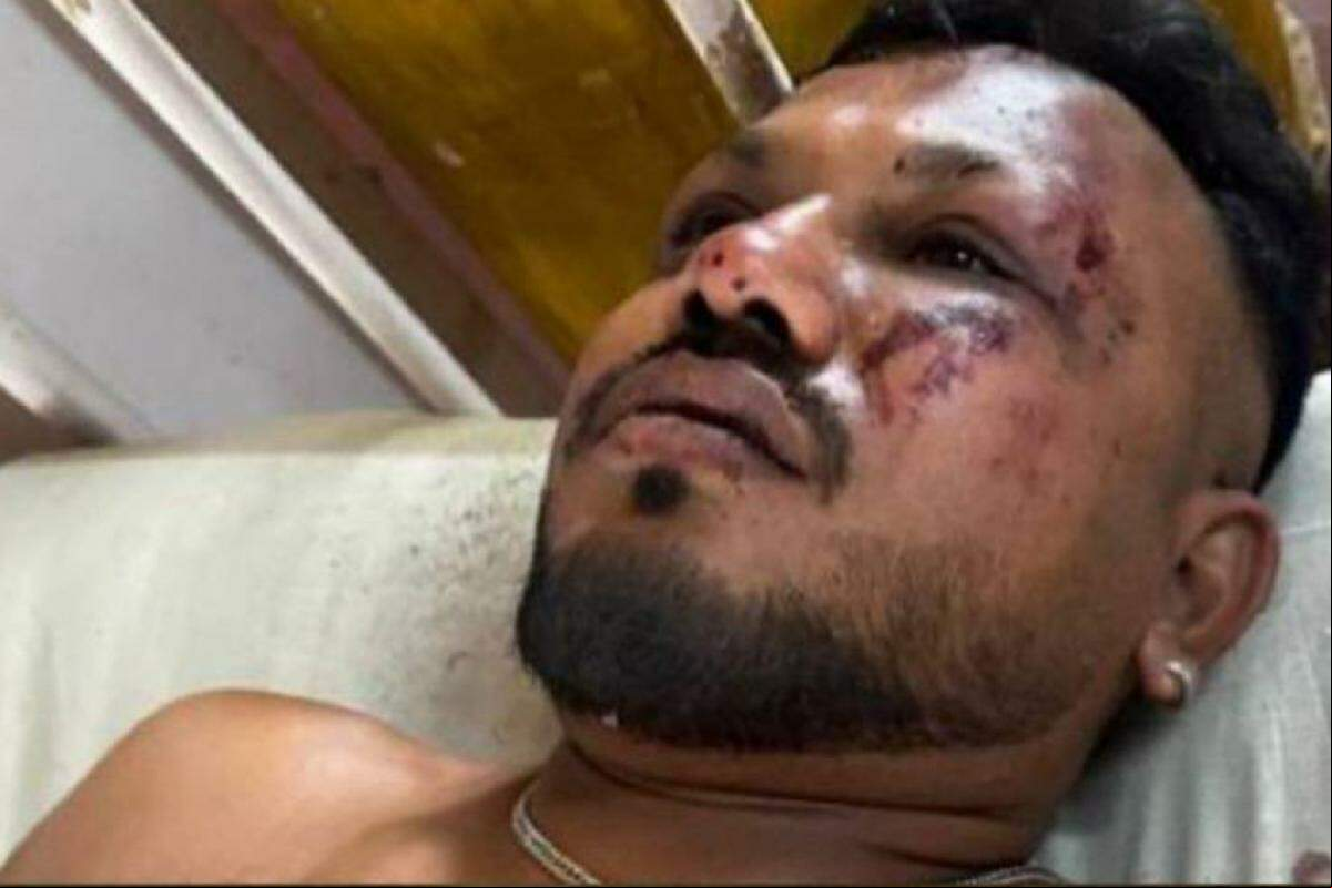 A vítima, identificada como o britânico Vishwas Kumar Ramesh, está sendo atendido em um hospital local.